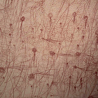 caveng_KUNSTASYL photo